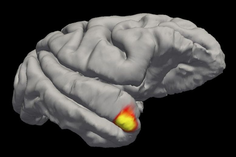 Neurons in the brain's temporal pole