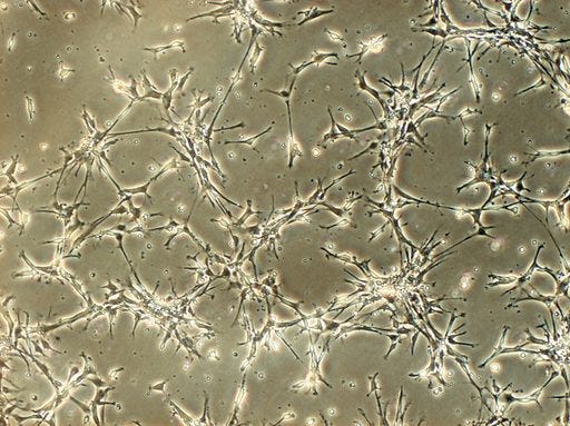 Neural stem cells in culture, showcasing research potential.